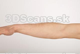 Photo reference of forearm 0001